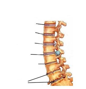 Etapas de desarrollo de la osteocondrosis