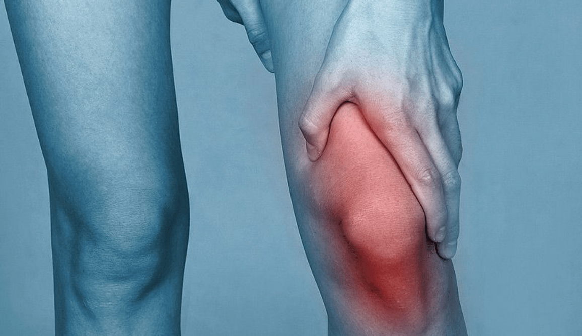 dolor en la articulación de la rodilla debido a artrosis